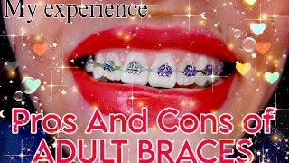 My Pros and Cons of braces And my experience having adult braces LolBorges [upl. by Joselow]