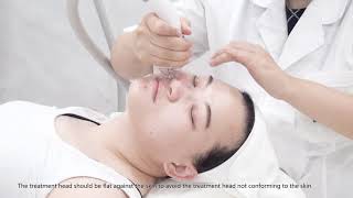 Velashape face lifting wrinkle removal treatment Sano Laser [upl. by Anerahs]