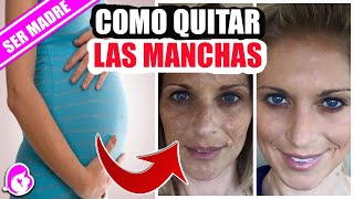 Cómo quitar las manchas en la cara del embarazo [upl. by Zohar533]