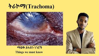 ለአይነ ስውርነት የሚዳርገው ትራኮማ Trachoma and its laboratory diagnosis Dr seife donkeytube Tenamedia [upl. by Enreval]