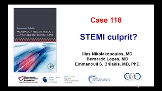 Case 118 PCI Manual  STEMI culprit [upl. by Amitaf]