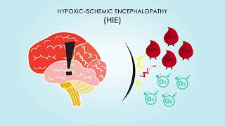 HypoxicIschemic Encephalopathy About Treatments amp Causes [upl. by Nihhi]