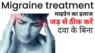 Migraine ka ilaj  Migraine treatment at home in Hindi [upl. by Naujahs469]