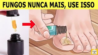 👣REMOVE FUNGOS SÓ 3 Gotas Deste Óleo Para Eliminar os FUNGOS DAS UNHAS em Poucos Dias [upl. by Aikit]