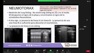 NEUMOTORAX OPTIMIZACION DE VENTILACION EN ESCAPES DE AIRE DRENAJES [upl. by Anika601]