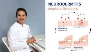 Neurodermitis  Ärztin erklärt worauf man achten sollte [upl. by Susejedesoj]