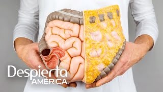 Síntomas del cáncer de colon y cómo prevenirlo [upl. by Melamed]