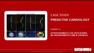 Megah diagnosi Predittiva [upl. by Lowrance]