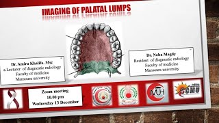 Imaging of palatal lumps by DrNoha Magdey and Dr Amira Khalefa MSc [upl. by Yllek]