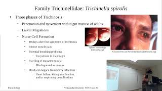 Trichinella spiralis [upl. by Rachelle580]