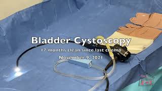 Cystoscopy of Bladder and Prostate November 2021 [upl. by Nolrev]