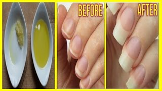 Comment FAIRE POUSSER LES ONGLES plus VITE NATURELLEMENT [upl. by Deeann]