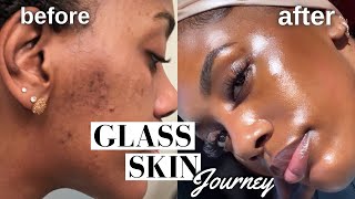 HOW I CLEARED MY HYPERPIGMENTATION ACNE AND DARK SPOTS  GLASS SKIN ROUTINE MUST WATCH [upl. by Sassan]