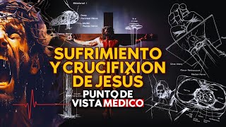 SUFRIMIENTO Y CRUCIFIXION DE JESÚS Punto de vista medico [upl. by Boykins552]