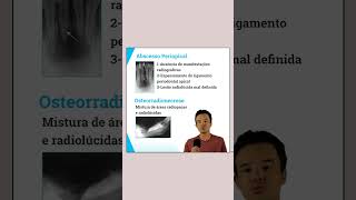 Osteíte Condensante  Características Clínicas e Radiográficas  Resumo Concurso Odontologia [upl. by Marijo]