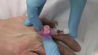 Cannulation How to gain IV access [upl. by Maryanne831]