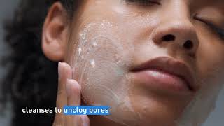 Clear Acne and Prevent New Breakouts │ CeraVe Skincare [upl. by Ojela]