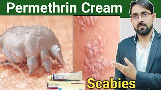 permethrin cream uses in hindi  scabies treatment in hindi  scabies permethrin cream Drx Rabbani [upl. by Euqilegna728]