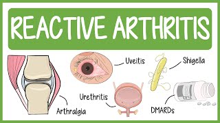 Reactive Arthritis with Mnemonics [upl. by Aikemal]