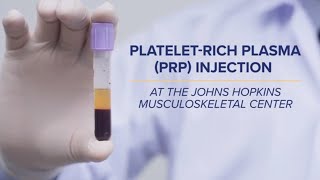 PlateletRich Plasma PRP Injections  QampA [upl. by Sperry]