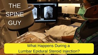 What Happens During a Lumbar Epidural Steroid Injection [upl. by Dillie]