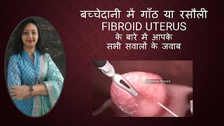 बच्चेदानी में गाँठ या रसौली  FIBROID UTERUS  All Questions Answered [upl. by Caiaphas]