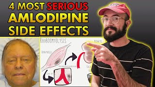 4 Most SERIOUS Amlodipine Side Effects [upl. by Lirba955]