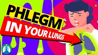 Top 10 Ways to Get Rid of Constant Mucus and Phlegm in Your Throat [upl. by Sdlonyer]