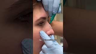 What is rhinoplasty DocTalkWithDrB  8 West Clinic  Vancouver BC [upl. by Bluefield]