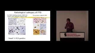 Frontotemporal dementia an overview [upl. by Burty157]