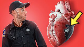 CARDIOGENIC SHOCK Explained In Under 6 Minutes [upl. by Coheman]