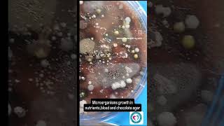 MICROORGANISM GROWTH IN PETRIDISH dmltscience medical microbiology BLOOD AGAR CHOCHLATE AGAR [upl. by Olcott]