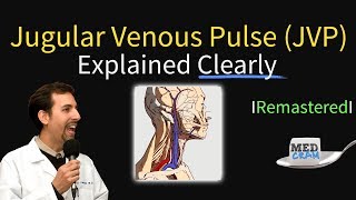 Jugular Venous Pulse JVP  Waveforms amp Evaluation for JVD [upl. by Komarek]