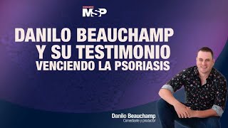 Venciendo la Psoriasis  Danilo Beauchamp  ExclusivoMSP [upl. by Clemente]