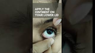 HOW TO APPLY EYE OINTMENT PROPERLY  NEW VISION EYE HOSPITAL MUNDAKAYAMPOONJAR [upl. by Osbourne]