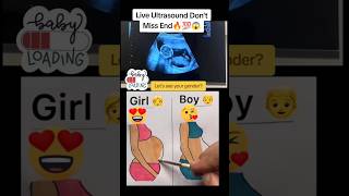 Live pregnancy ultrasound dont miss the end🥰🔥🥰viralvideo trending viralshorts [upl. by Shamus]