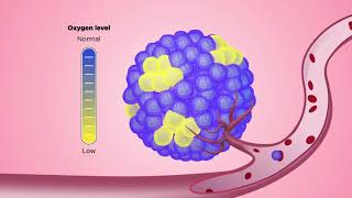 How do clustered circulating tumor cells initiate metastasis [upl. by Franny]