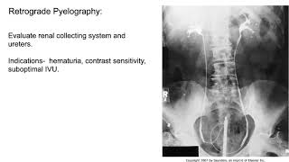 Radiology of the Urogenital system [upl. by Revlys]