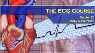 The ECG Course  Ectopy amp Aberrancy [upl. by Robinet]