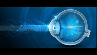 MRCP Endpoints ophthalmology Questions Passmedicine [upl. by Lawtun]