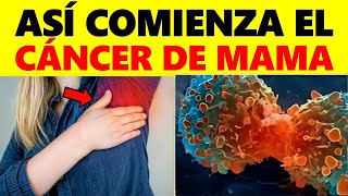 Síntomas Iniciales de Cáncer de Mama que Casi Nadie Nota ¡Reconoce Antes de que Sea Demasiado Tarde [upl. by Edya953]