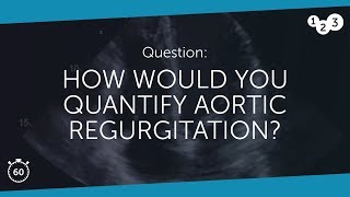 60 Seconds of Echo Teaching Question How would you quantify aortic regurgitation [upl. by Gerrard331]