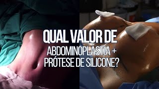 QUAL VALOR DE ABDOMINOPLASTIA COM PRÓTESE DE SILICONE  CIRURGIA PLÁSTICA [upl. by Beuthel620]