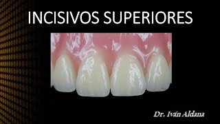 ANATOMÍA DENTARIA  Unidad 21 INCISIVOS SUPERIORES  DR IVÁN ALDANA [upl. by Eveineg]