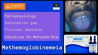 Methemoglobinemeia  Saturation gap  Methylene blue [upl. by Aipotu]