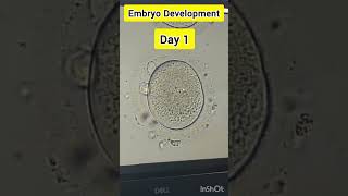 Embryo development process in IVF embryology embryodevelopment embryologist ivf ivfprocess [upl. by Ainezey]