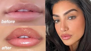 how to get juicy fuller lips with makeup [upl. by Pearla]