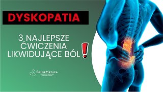 💥Dyskopatia  3 najlepsze ćwiczenia likwidujące ból💥 [upl. by Verras666]