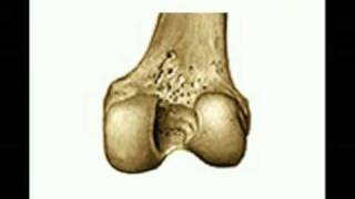 OSTEOLOGIA DE MIEMBRO INFERIOR 5 Diagnostico X [upl. by Ataeb]