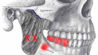 Masseter Muscle Assessment [upl. by Elbon]